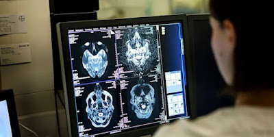 Whistleblower warns baffling illness affects growing number of young adults in Canadian province
